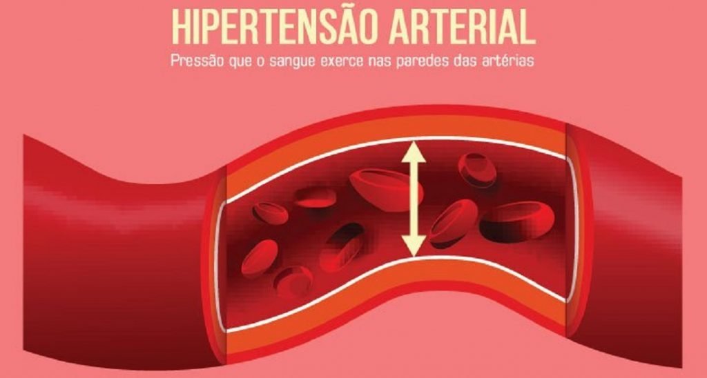 hipertensão arterial