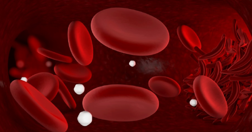 anemia sintomas e causas
