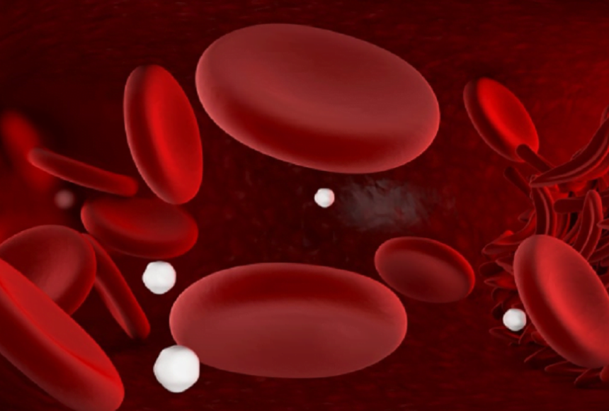 anemia sintomas e causas