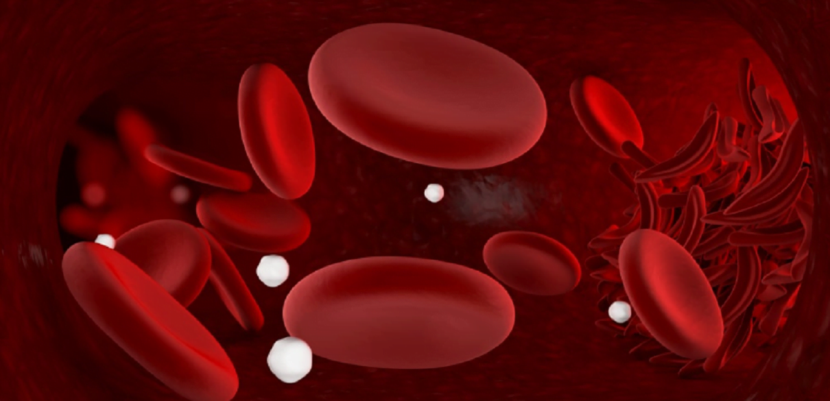 anemia sintomas e causas