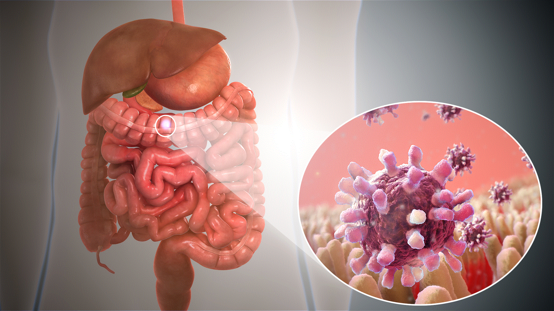 gastroenterite-causas-sintomas-e-tratamento