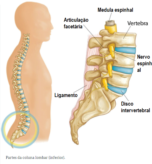 Disco intervertebral onde pode ocorrer a hérnia de disco