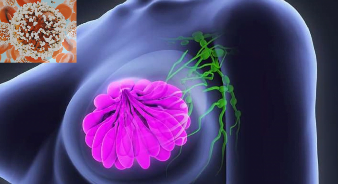 Será que os hormonas da menopausa causam câncer da mama?
