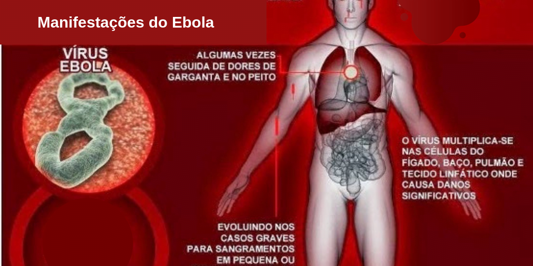 como se manifesta a infeção por vírus ebola