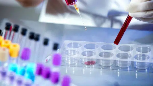 acidose metabólica