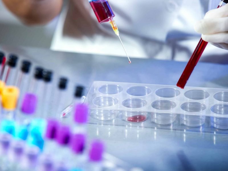 acidose metabólica