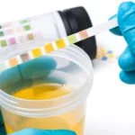 testes da função renal