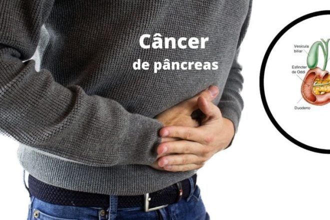 Câncer de pâncreas