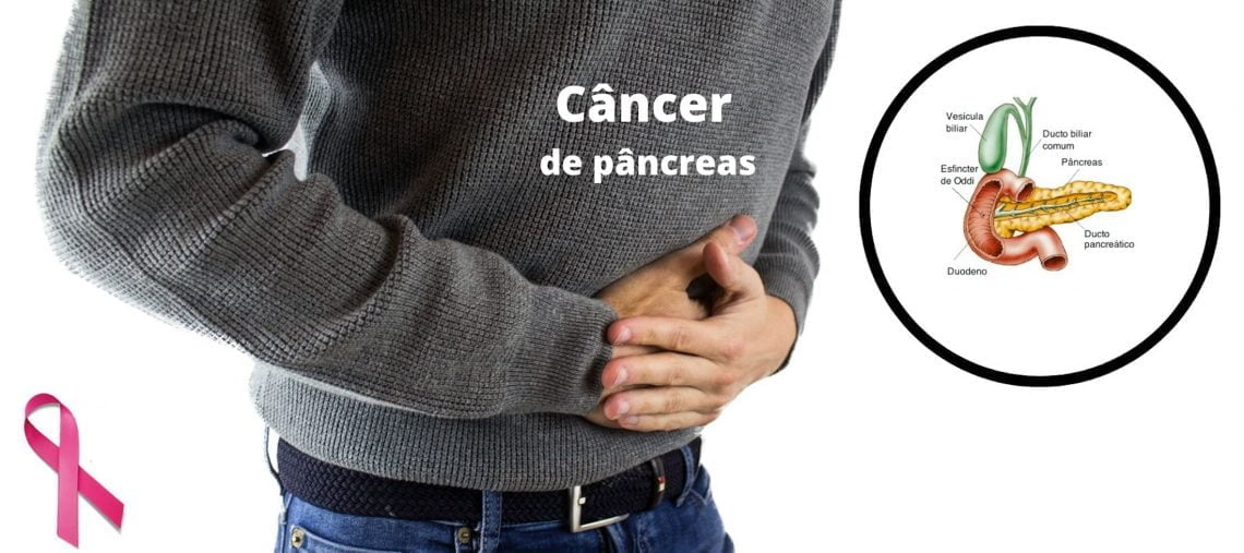 Câncer de pâncreas
