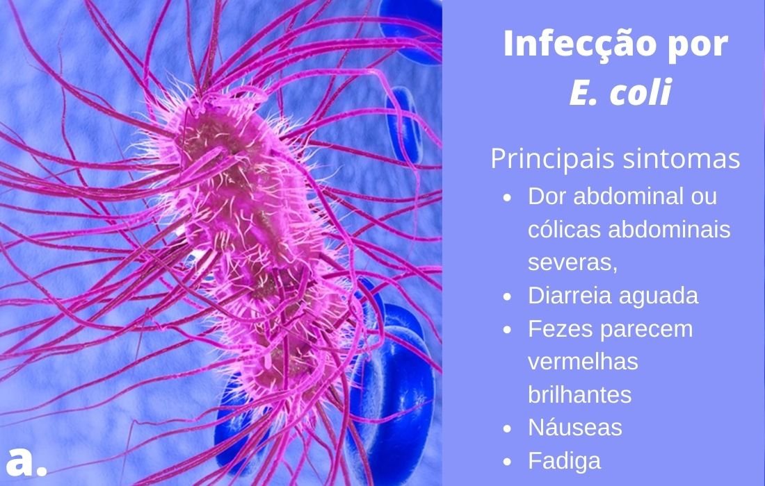 Escherichia Coli Sintomas Causas E Tratamento