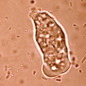 Entamoeba hystolica causadora da disenteria