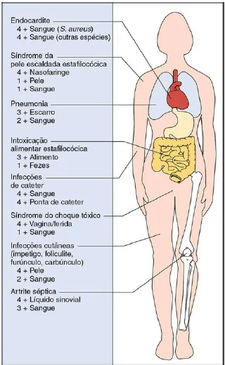 doenças causadas pelos Staphylococcus