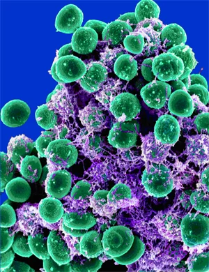 Staphylococcus epidermitis