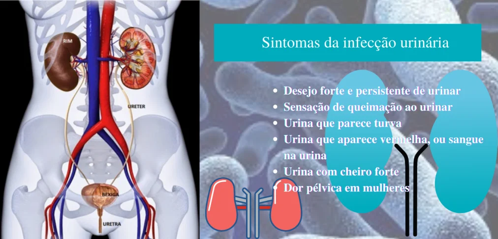 principais sintomas da infeção do trato urinário