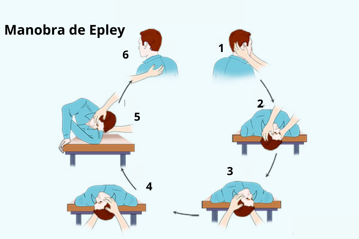 Vertigo epley maneuver manobra vertigem tratamento remedies emedihealth bppv eply eplay importantes aspectos movimentos