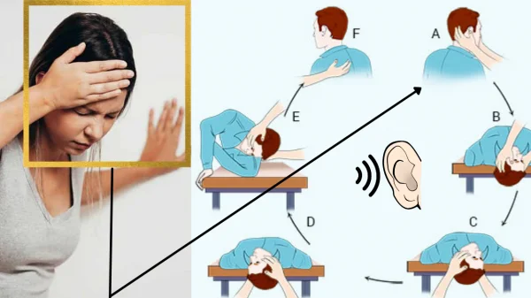 tratamento da vertigem
