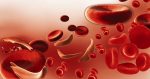 exemplo de uma anemia hemolítica - a falciforme