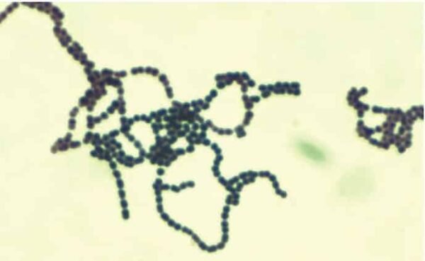 Streptococcus Spp (estrepetocos): Tipos, Doenças E Toxinas