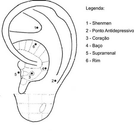 pontos de acupuntura na orelha para ansiedade